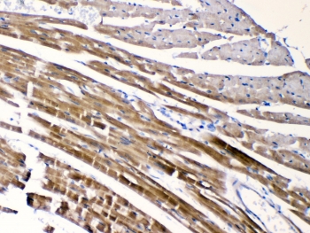 IHC testing of FFPE mouse heart tissue with CHRNA5 antibody at 1ug/ml. Required HIER: steam section in pH6 citrate buffer for 20 min and allow to cool prior to testing.