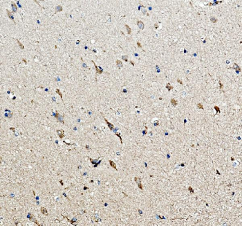 Immunohistochemistry analysis of MC3 Receptor/MC3R Antibody in human hippocampus tissue. Paraffin-embedded human hippocampus sections were subjected to heat-mediated antigen retrieval in EDTA buffer (pH 8.0) and incubated with MC3 Receptor/MC3R Antibody, followed by HRP-conjugated secondary antibody and DAB chromogen development. Brown immunoreactivity is observed in neuronal cells within the hippocampal region, with hematoxylin nuclear counterstain (blue).