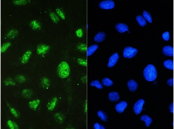 STAT1 Antibody U-2 OS IF/ICC. Immunofluorescent staining of FFPE human U-2 OS cells using STAT1 antibody demonstrates prominent green fluorescence within both the nucleus and cytoplasm, consistent with the known subcellular localization and signaling function of Signal Transducer and Activator of Transcription 1 (STAT1). STAT1 is a key transcription factor within the JAK-STAT signaling pathway that undergoes activation-dependent nuclear translocation to regulate expression of interferon-responsive and cytokine-regulated genes. The observed staining pattern is consistent with the role of STAT1 in transcriptional regulation, immune signaling, and cellular responses to extracellular stimuli. Nuclei are visualized with DAPI nuclear stain (blue). HIER: steam section in pH6 citrate buffer for 20 min and allow to cool prior to testing.