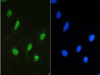 STAT1 Antibody U-2 OS Cell IF. Immunofluorescent staining of FFPE human U-2 OS cells using STAT1 antibody demonstrates strong green fluorescence predominantly within the nucleus, consistent with the role of Signal Transducer and Activator of Transcription 1 (STAT1) as a transcription factor that translocates to the nucleus following activation. STAT1 is a central mediator of JAK-STAT signaling and regulates expression of genes involved in interferon responses, cytokine signaling, immune regulation, and cellular adaptation to extracellular stimuli. The observed nuclear staining pattern is consistent with transcriptionally active STAT1 participating in signal-dependent gene regulation. Nuclei are visualized with DAPI nuclear stain (blue). HIER: steam section in pH6 citrate buffer for 20 min and allow to cool prior to testing.