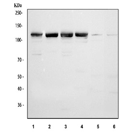 Western blot testing of 1) human HeLa, 2) human A549, 3) HUVEC, 4) human MCF7, 5) rat liver and 6) mouse liver lysate with ECE1 antibody at 0.5ug/ml. The predicted molecular weight of ECE1 is approximately 87 kDa; however, the mature glycosylated protein migrates at approximately 120 to 130 kDa. Human cell lines show a clear doublet corresponding to distinct glycoforms, while rodent liver displays a slightly faster migrating band consistent with species specific glycosylation patterns.