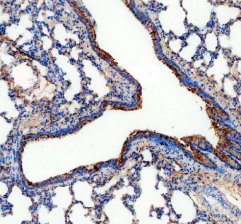 ALDH1A3 Antibody Rat Lung IHC. Immunohistochemistry staining of FFPE rat lung tissue using ALDH1A3 antibody with HRP-secondary and DAB chromogen demonstrates prominent cytoplasmic staining of bronchiolar and airway-associated epithelial cells, consistent with expression of Aldehyde Dehydrogenase 1 Family Member A3 (ALDH1A3). Also known as retinaldehyde dehydrogenase 3 (RALDH3), ALDH1A3 is an NAD-dependent enzyme that catalyzes the conversion of retinaldehyde to retinoic acid, thereby regulating retinoid metabolism and differentiation-associated signaling pathways. The observed staining pattern is consistent with the role of ALDH1A3 in epithelial homeostasis, tissue maintenance, and cellular differentiation within the respiratory tract. These findings support the utility of ALDH1A3 antibody for studies of retinoic acid biology, developmental metabolism, and tissue-specific regulation. HIER: boil tissue sections in pH 8 EDTA for 20 min and allow to cool before testing.