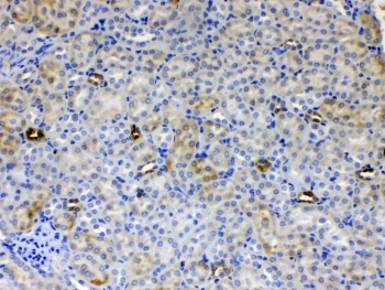 ALDH1A3 Antibody Mouse Kidney IHC. Immunohistochemistry staining of FFPE mouse kidney tissue using ALDH1A3 antibody demonstrates weak to moderate cytoplasmic staining within renal tubular epithelial cells, consistent with expression of Aldehyde Dehydrogenase 1 Family Member A3 (ALDH1A3). Also known as retinaldehyde dehydrogenase 3 (RALDH3), ALDH1A3 is an NAD-dependent enzyme that catalyzes the conversion of retinaldehyde to retinoic acid, thereby contributing to retinoid metabolism and regulation of differentiation-associated signaling pathways. The observed staining pattern is consistent with the role of ALDH1A3 in tissue homeostasis, cellular metabolism, and maintenance of specialized epithelial functions. These findings support the utility of ALDH1A3 antibody for studies of retinoic acid biology, tissue differentiation, and developmental metabolism. Required HIER: steam section in pH6 citrate buffer for 20 min and allow to cool prior to testing.