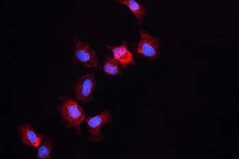ALDH1A3 Antibody A431 IF. Immunofluorescent staining of human A431 cells using ALDH1A3 antibody demonstrates prominent cytoplasmic red fluorescence, consistent with expression of Aldehyde Dehydrogenase 1 Family Member A3 (ALDH1A3). Also known as retinaldehyde dehydrogenase 3 (RALDH3), ALDH1A3 is an NAD-dependent enzyme that catalyzes the conversion of retinaldehyde to retinoic acid, thereby regulating retinoid metabolism and differentiation-associated signaling pathways. The observed cytoplasmic localization is consistent with the enzymatic function of ALDH1A3 and supports the utility of this antibody for studies of retinoic acid synthesis, stem cell biology, tissue differentiation, and cancer-associated cellular plasticity. Nuclei are visualized with DAPI nuclear stain (blue).