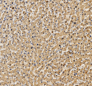 LEPR Polyclonal Antibody by IHC in human liver. Immunohistochemistry of FFPE human liver tissue using LEPR Polyclonal Antibody at 2 ug/ml. Brown DAB staining is observed throughout the hepatocyte population, predominantly in the cytoplasm with a granular distribution and some peripheral membrane-associated staining. Nuclei are counterstained blue with hematoxylin. Heat-induced epitope retrieval was performed using EDTA buffer, pH 8.0, followed by overnight primary antibody incubation at 4oC. This Leptin Receptor Rabbit Antibody recognizes LEPR, a cytokine receptor involved in leptin-dependent signaling and metabolic homeostasis.