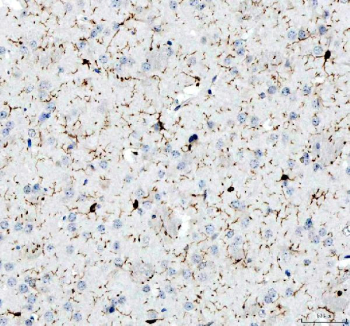 AIF1 Antibody Mouse Brain IHC. Immunohistochemistry analysis of paraffin-embedded mouse brain tissue using AIF1 Antibody demonstrates HRP-DAB brown cytoplasmic staining in microglial cells distributed throughout the neural parenchyma, with characteristic ramified morphology and fine cellular processes consistent with AIF1 / IBA1 expression as a microglia marker involved in neuroinflammatory response and immune surveillance, while neurons and glial cells remain largely negative; nuclei are counterstained blue. HIER: heat-mediated antigen retrieval in EDTA buffer (pH 8.0).