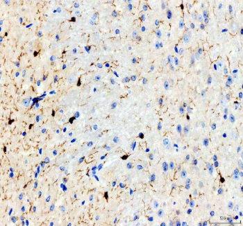AIF1 Antibody Mouse Brain IHC. Immunohistochemistry analysis of paraffin-embedded mouse brain tissue using AIF1 Antibody demonstrates HRP-DAB brown cytoplasmic staining in scattered microglial cells within the neural parenchyma, showing characteristic ramified morphology with fine branching processes consistent with AIF1 / IBA1 expression as a microglia marker involved in neuroimmune surveillance and inflammatory activation, while surrounding neurons and other glial cells remain largely negative; nuclei are counterstained blue. HIER: heat-mediated antigen retrieval in EDTA buffer (pH 8.0).