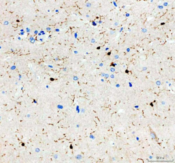 AIF1 Antibody Rat Brain IHC. Immunohistochemistry analysis of paraffin-embedded rat brain tissue using AIF1 Antibody demonstrates HRP-DAB brown cytoplasmic staining in dispersed microglial cells throughout the neural parenchyma, exhibiting characteristic ramified morphology with elongated processes consistent with AIF1 / IBA1 expression as a microglia marker associated with neuroimmune surveillance and activation, while surrounding neuronal cells remain largely negative; nuclei are counterstained blue. HIER: heat-mediated antigen retrieval in EDTA buffer (pH 8.0).