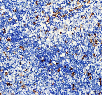 AIF1 Antibody Spleen IHC. IBA1/AIF-1 was detected in paraffin-embedded sections of human spleen tissue. Heat-mediated antigen retrieval was performed in EDTA buffer (pH 8.0). The tissue sections were blocked with 10% goat serum and incubated with rabbit anti-IBA1/AIF-1 antibody overnight at 4Â°C. Peroxidase-conjugated goat anti-rabbit IgG was used as secondary antibody and incubated for 30 minutes at 37Â°C. The tissue sections were developed using an HRP-conjugated detection system with DAB as the chromogen.
