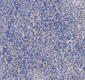 AIF1 Antibody Human Spleen Tissue IHC. IBA1/AIF-1 was detected in paraffin-embedded sections of human spleen tissue. Heat-mediated antigen retrieval was performed in EDTA buffer (pH 8.0). The tissue sections were blocked with 10% goat serum and incubated with rabbit anti-IBA1/AIF-1 antibody overnight at 4Â°C. Peroxidase-conjugated goat anti-rabbit IgG was used as secondary antibody and incubated for 30 minutes at 37Â°C. The tissue sections were developed using an HRP-conjugated detection system with DAB as the chromogen.