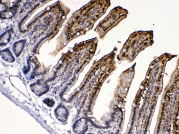 IHC testing of FFPE mouse intestine tissue with FABP2 antibody at 1ug/ml. Required HIER: steam section in pH6 citrate buffer for 20 min and allow to cool prior to testing.