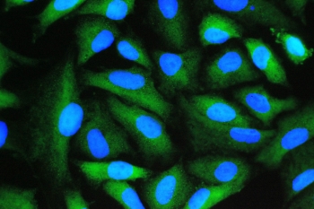 Cyclophilin A Antibody IF. Immunofluorescent staining demonstrates Cyclophilin A (PPIA) expression as diffuse cytoplasmic green fluorescence throughout the cell population, with relative exclusion from DAPI-stained blue nuclei. The staining pattern is consistent with the known intracellular localization of Cyclophilin A, a highly abundant peptidyl-prolyl cis-trans isomerase that functions as a molecular chaperone involved in protein folding, protein trafficking, and cellular stress response pathways. Robust cytoplasmic immunoreactivity supports the widespread expression of Cyclophilin A in metabolically active cells and demonstrates the utility of this antibody for immunofluorescence applications. Nuclei are counterstained with DAPI (blue).