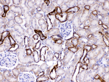 GAD65 Antibody Rat Kidney IHC. Immunohistochemistry testing of FFPE rat kidney tissue with GAD65 antibody at 1ug/ml. Required HIER: steam section in pH6 citrate buffer for 20 min and allow to cool prior to testing.