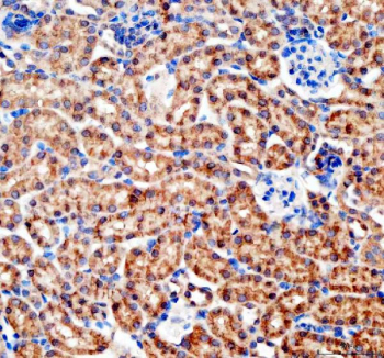 IHC staining of FFPE mouse kidney tissue with Bax antibody, HRP-labeled secondary and DAB substrate. HIER: boil tissue sections in pH8 EDTA for 20 min and allow to cool before testing.