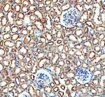 IHC staining of FFPE rat kidney tissue with Bax antibody, HRP-labeled secondary and DAB substrate. HIER: boil tissue sections in pH8 EDTA for 20 min and allow to cool before testing.