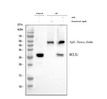 Bcl-XL Antibody IP. Immunoprecipitation analysis of Bcl-XL from human A549 whole cell lysate using Bcl-XL Antibody / Anti-Apoptotic Protein Antibody demonstrates specific enrichment of BCL2L1 following antibody-mediated pull-down. Bcl-XL is detected as a distinct band at approximately 26-30 kDa in the immunoprecipitated sample, consistent with the expected molecular weight of the major anti-apoptotic BCL2L1 isoform. The result confirms specific recognition and capture of endogenous Bcl-XL protein from cellular lysates. Bcl-XL functions as a key regulator of mitochondrial apoptosis, promoting cell survival through inhibition of pro-apoptotic BCL2 family members and preservation of mitochondrial integrity. Immunoprecipitation was performed using 2 ug of Bcl-XL antibody and 500 ug of human A549 whole cell lysate. The IgG heavy chain is visible at approximately 50 kDa.