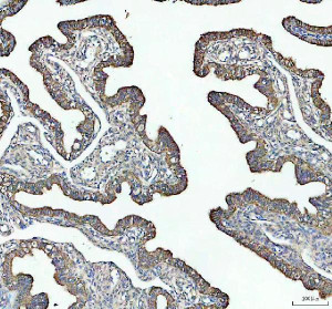 HFE Antibody Human Fallopian Tube IHC. Immunohistochemical analysis of FFPE human fallopian tube tissue following heat-induced epitope retrieval in pH8 EDTA buffer. Tissue sections were incubated with HFE Antibody at 2 ug/ml overnight, followed by an HRP-conjugated secondary antibody and DAB chromogen for visualization. Moderate membranous and cytoplasmic staining is observed in the epithelial cells lining the mucosal folds, consistent with the localization of HFE as a membrane-associated regulator of iron homeostasis. This staining pattern demonstrates that this HFE Antibody, a Hereditary Hemochromatosis Protein Antibody, is suitable for detecting endogenous HFE expression in human FFPE tissue by immunohistochemistry.