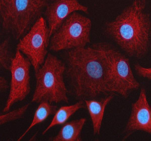 HFE Antibody A549 Cell IF. Immunofluorescence analysis of A549 cells following enzymatic antigen retrieval. Cells were incubated with HFE Antibody at 5 ug/ml overnight, followed by a Cy3-conjugated secondary antibody. Nuclei were counterstained with DAPI (blue). HFE staining (red) is observed predominantly in the cytoplasm with membranous enrichment, consistent with the localization of this membrane-associated protein involved in iron sensing and systemic iron homeostasis. This staining pattern demonstrates that this HFE Antibody, a Hereditary Hemochromatosis Protein Antibody, is suitable for visualizing endogenous HFE expression and subcellular distribution in cultured cells by immunofluorescence.