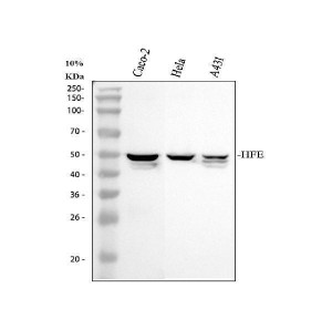 HFE Antibody Human Epithelial Cell WB. Western blot analysis of HFE was performed using lysates from human Caco-2, HeLa, and A431 cells. A prominent band is detected at approximately 48-50 kDa in each cell line. Although the predicted molecular weight of HFE is approximately 40 kDa, the protein is commonly observed at a higher apparent molecular weight due to N-linked glycosylation, a post-translational modification required for proper folding, association with beta-2 microglobulin, and cell surface expression. These results demonstrate that this HFE Antibody, a Hereditary Hemochromatosis Protein Antibody, specifically detects endogenous HFE in multiple human epithelial cell lines by Western blot.