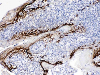 IHC testing of FFPE human tonsil tissue with FDCSP antibody at 1ug/ml. Required HIER: steam section in pH6 citrate buffer for 20 min and allow to cool prior to testing.