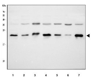 HSP22 Antibody Human, Mouse and Rat WB. Western blot testing of human MCF7, human U-87 MG, rat H9C2, rat heart, rat C2C12, mouse skeletal muscle and mouse heart lysates with HSP22 Antibody at 0.5 ug/ml. Lane 1: human MCF7; Lane 2: human U-87 MG; Lane 3: rat H9C2; Lane 4: rat heart; Lane 5: rat C2C12; Lane 6: mouse skeletal muscle; Lane 7: mouse heart. HSP22 was detected at approximately 22-27 kDa, consistent with the expected molecular weight of HSPB8. HSP22 Antibody / Small Heat Shock Protein Antibody supports studies of molecular chaperone activity, protein homeostasis and cellular stress response pathways.