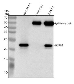 HSP22 Antibody MCF7 Cell IP. Immunoprecipitation of HSP22 from human MCF7 whole cell lysate using HSP22 Antibody. MCF7 lysate input and immunoprecipitated samples were analyzed by Western blot, with rabbit control IgG included as a negative control. HSP22 antibody was used at 2 ug for immunoprecipitation, and a specific band was detected at approximately 22-27 kDa, consistent with the expected molecular weight of HSPB8. HSP22 Antibody / Small Heat Shock Protein Antibody supports protein interaction studies and analysis of molecular chaperone activity, protein quality control and cellular stress response pathways.
