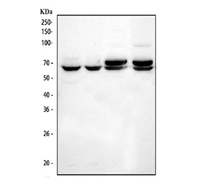 Western blot analysis of ANGPTL2 expression in HUVEC cells, human SH-SY5Y cells, rat heart tissue, and mouse heart tissue. Predicted molecular weight of ANGPTL2 is ~57 kDa. Bands are observed at ~60â65 kDa, with a doublet present in heart tissue, consistent with glycosylation-dependent mobility shifts and tissue-specific post-translational processing.