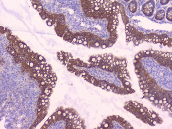 Beta-Catenin Antibody Rat Small Intestine Tissue IHC. Immunohistochemistry analysis of FFPE rat small intestine tissue using Beta-Catenin antibody shows strong membranous staining along epithelial cell borders lining villi and crypt structures, consistent with CTNNB1 / Catenin beta-1 localization at adherens junctions, with mild cytoplasmic signal in enterocytes. Intestinal architecture is well preserved, and underlying stromal compartments display comparatively low staining intensity. Hematoxylin counterstain provides nuclear contrast and structural context. HIER: steam FFPE sections in pH 6 citrate buffer for 20 min and allow to cool prior to testing.