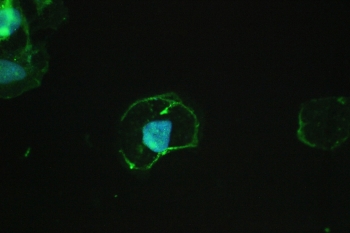 Beta-Catenin Antibody A431 Cell IF. Immunofluorescence analysis of FFPE human A431 cells using Beta-Catenin antibody shows distinct membranous green fluorescence outlining cell borders, consistent with CTNNB1 / Catenin beta-1 localization at adherens junctions, with minimal cytoplasmic signal. DAPI nuclear stain (blue) highlights nuclei, providing contrast to the peripheral staining pattern. HIER: steam FFPE sections in pH 6 citrate buffer for 20 min and allow to cool prior to testing.
