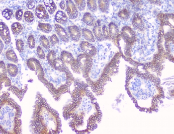 Beta-Catenin Antibody Mouse Small Intestine Tissue IHC. Immunohistochemistry analysis of FFPE mouse small intestine tissue using Beta-Catenin antibody shows strong membranous staining along epithelial cell borders lining the villi and crypts, consistent with CTNNB1 / Catenin beta-1 localization at adherens junctions, with mild cytoplasmic signal in enterocytes. Intestinal architecture is clearly preserved, and underlying stromal regions display comparatively low staining. Hematoxylin counterstain provides nuclear contrast and tissue context. HIER: steam FFPE sections in pH 6 citrate buffer for 20 min and allow to cool prior to testing.