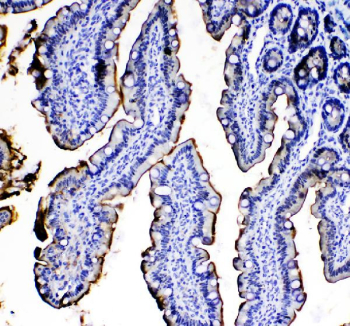 Immunohistochemical staining of IL-33 in mouse colon tissue using Il-33 antibody, HRP-conjugated secondary antibody and DAB substrate. Nuclear and cytoplasmic staining is observed in epithelial cells. HIER: steam section in pH8 EDTA buffer for 20 min.