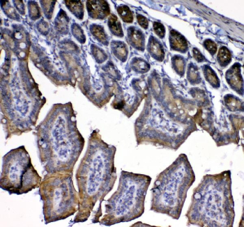 Immunohistochemical staining of mouse colon tissue using IL-33 antibody. Staining was performed with an HRP-conjugated secondary antibody and DAB substrate, with hematoxylin counterstaining. Staining is observed in epithelial and stromal regions. HIER: steam section in pH8 EDTA buffer for 20 min.
