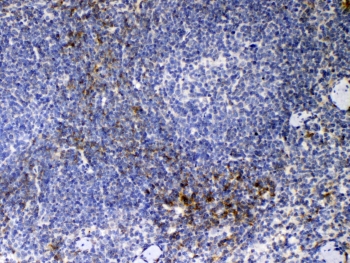 Immunohistochemistry analysis of Cd14 antibody in mouse spleen tissue. Formalin-fixed, paraffin-embedded mouse spleen tissue was stained using Cd14 antibody at a concentration of 1 ug per mL. Heat-induced epitope retrieval was performed by steaming tissue sections in citrate buffer, pH 6.0, for 20 minutes, followed by cooling prior to antibody incubation. Brown chromogenic signal is observed in scattered immune cells within splenic red pulp and perifollicular regions, consistent with Cd14-positive myeloid cell populations, while the majority of lymphoid cells in white pulp areas show little to no staining. This staining pattern reflects myeloid lineage-associated expression of Cd14 in mouse spleen tissue.