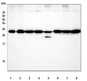 Western blot testing of 1) human PC-3, 2) human RT4, 3) human A549, 4) human Caco-2, 5) rat thymus, 6) rat PC-12, 7) mouse thymus and 8) mouse A20 cell lysate with RAN antibody at 0.5ug/ml. Predicted molecular weight ~25 kDa.