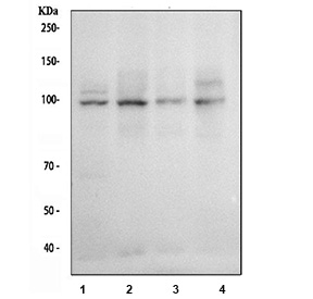 Western blot testing of human 1) Jurkat, 2) Daudi, 3) Ramos and 4) Raji cell lysate with NFAT2 antibody at 0.5ug/ml. Predicted molecular weight: ~77 kDa (isoform A), ~88 kDa (isoform B), ~101 kDa (isoform C).