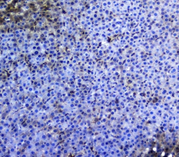 IHC staining of FFPE rat liver with TRAIL antibody. HIER: boil tissue sections in pH6, 10mM citrate buffer, for 20 min and allow to cool before testing.