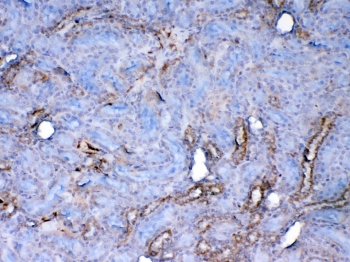 Galectin 1 Antibody Rat Kidney IHC. Immunohistochemical staining of FFPE rat kidney tissue using Galectin 1 antibody at 1 ug/ml demonstrates cytoplasmic and membranous HRP-DAB brown staining within renal tubular epithelial cells and associated kidney structures. The observed staining pattern is consistent with expression of Galectin-1 (LGALS1), a beta-galactoside-binding lectin involved in cell adhesion, immune regulation, extracellular matrix remodeling, tissue repair, and glycan-mediated signaling pathways. Positive immunoreactivity is primarily localized to tubular compartments, supporting the known role of Galectin-1 in renal physiology and cellular communication within the kidney microenvironment. HIER: steam section in pH6 citrate buffer for 20 min and allow to cool prior to testing.