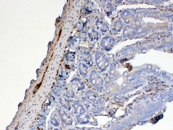 Galectin 1 Antibody Rat Small Intestine IHC. Immunohistochemical staining of FFPE rat small intestine tissue using Galectin 1 antibody at 1 ug/ml demonstrates cytoplasmic and membranous HRP-DAB brown staining within intestinal epithelial cells and mucosal-associated cellular structures. The observed staining pattern is consistent with expression of Galectin-1 (LGALS1), a beta-galactoside-binding lectin involved in cell adhesion, immune regulation, epithelial homeostasis, extracellular matrix interactions, and glycan-mediated signaling pathways. Positive immunoreactivity is present within the intestinal mucosa, supporting the role of Galectin-1 in maintaining gastrointestinal tissue integrity and cellular communication within the intestinal microenvironment. HIER: steam section in pH6 citrate buffer for 20 min and allow to cool prior to testing.
