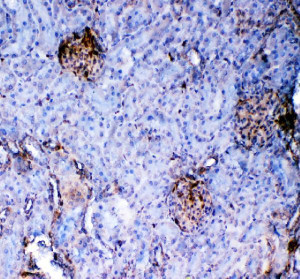 Galectin 1 Antibody Rat Kidney IHC. Immunohistochemistry was performed on FFPE rat kidney tissue using Galectin 1 Antibody. Heat-induced epitope retrieval was performed in pH 8 EDTA buffer prior to incubation with the primary antibody at 2 ug/ml. Bound antibody was visualized using an HRP-conjugated goat anti-rabbit IgG secondary antibody with DAB chromogen. Predominantly cytoplasmic staining is observed in renal glomeruli and selected tubular epithelial cells, consistent with the reported distribution of Galectin 1 in kidney tissue. These results demonstrate that this Galectin 1 Antibody is suitable for immunohistochemical detection of Galectin 1 in formalin-fixed, paraffin-embedded rat kidney tissue.
