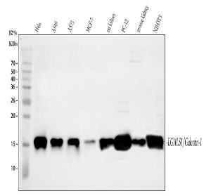Galectin 1 Antibody Human, Rat and Mouse WB. Western blot analysis was performed using Galectin 1 Antibody. Lane 1: human HeLa whole cell lysate; lane 2: human A549 whole cell lysate; lane 3: human A375 whole cell lysate; lane 4: human MCF-7 whole cell lysate; lane 5: rat kidney tissue lysate; lane 6: rat PC-12 whole cell lysate; lane 7: mouse kidney tissue lysate; lane 8: mouse NIH/3T3 whole cell lysate. Proteins were separated on a 13% SDS-PAGE gel, transferred to a nitrocellulose membrane, and incubated with the primary antibody at 0.5 ug/ml overnight at 4Â°C. A specific immunoreactive band is detected at approximately 15 kDa in all tested samples, consistent with the expected molecular weight of Galectin 1. These results demonstrate that this Galectin 1 Antibody is suitable for Western blot detection of Galectin 1 across human, rat, and mouse tissues and cell lines.