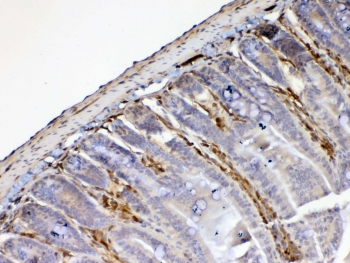 IHC testing of FFPE mouse small intestine tissue with Galectin 1 antibody at 1ug/ml. Required HIER: steam section in pH6 citrate buffer for 20 min and allow to cool prior to testing.