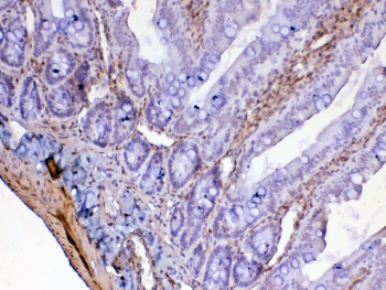 IHC testing of FFPE rat small intestine tissue with Galectin 1 antibody at 1ug/ml. Required HIER: steam section in pH6 citrate buffer for 20 min and allow to cool prior to testing.