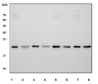 Western blot testing of human samples: 1) HeLa, 2) HL60, 3) HT29, 4) SKOV3, 5) SiHa, 6) U-2 OS, 7) PC-3 and 8) ThP-1 cell lysate with TIMP1 antibody at 0.5ug/ml. Expected molecular weight: 23-28 kDa depending on the level of glycosylation.
