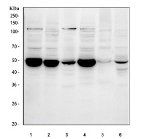 Western blot testing of 1) human MCF7, 2) human Caco-2, 3) human A549, 4) human K562, 5) rat testis and 6) mouse testis tissue lysate with PTP1B antibody. Predicted molecular weight ~50 kDa.