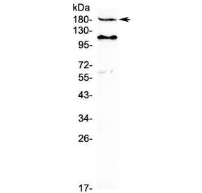 Western blot testing of human MCF7 cell lysate with VEGFR2 antibody at 0.5ug/ml. Predicted molecular weight: ~152 (immature), 180-200 kDa (intermediate) and 220-230 kDa (mature).