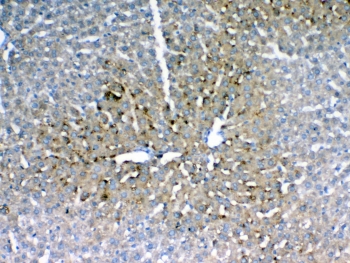 IHC testing of FFPE rat liver tissue with IGFBP1 antibody at 1ug/ml. Required HIER: steam section in pH6 citrate buffer for 20 min and allow to cool prior to testing.
