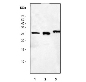 Western blot testing of 1) human placenta, 2) rat thymus and 3) mouse thymus tissue lysate with IL22 antibody. Expected molecular weight: 19~25 kDa depending on glycosylation level. 
