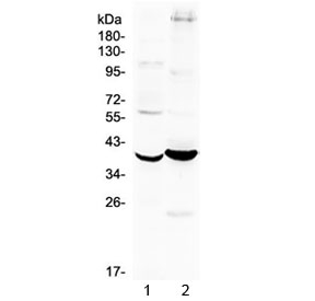 Follistatin Antibody / TGF Beta Signaling Regulator Human and Mouse WB. Western blot analysis of 1) mouse kidney and 2) human MCF7 cell lysates using Follistatin Antibody / TGF Beta Signaling Regulator at 0.5 ug/ml. A distinct immunoreactive band is detected at approximately 38 kDa in both samples, consistent with the predicted molecular weight of follistatin, supporting specific detection of the endogenous growth factor regulator across mouse and human lysates.