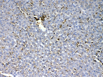 IHC testing of FFPE rat liver tissue with HBD antibody at 1ug/ml. Required HIER: steam section in pH6 citrate buffer for 20 min and allow to cool prior to testing.