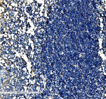 Immunohistochemical staining of FFPE human tonsil tissue with SCF antibody, HRP-secondary and DAB substrate. HIER: boil tissue sections in pH8 EDTA for 20 min and allow to cool before testing.